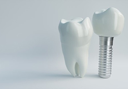 dental implant with a crown next to a natural tooth