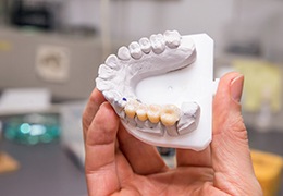 model of dental bridge in Goodlettsville