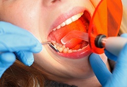 Closeup of patient during dental sealant application