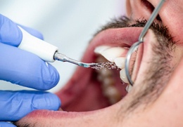 dentist cleaning a patient’s teeth