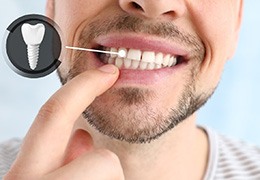 A man pointing out his implanted tooth against a light background