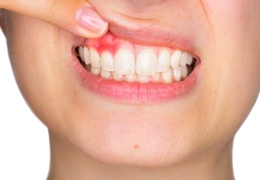 person needing gum disease treatment