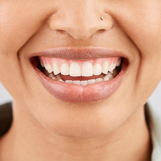 Close-up of woman’s smile with healthy teeth and gums