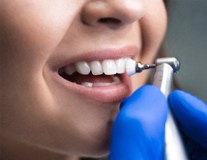 We offer smile saving dental checkups and cleanings near Hendersonville